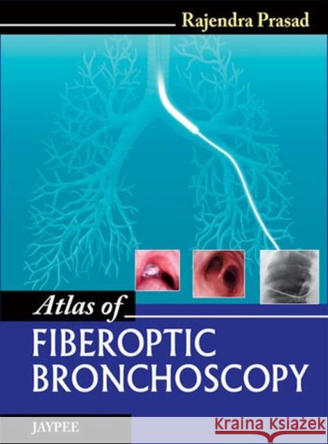 Atlas of Fiberoptic Bronchoscopy Rajendra Prasad 9789350903407 Jp Medical Ltd - książka