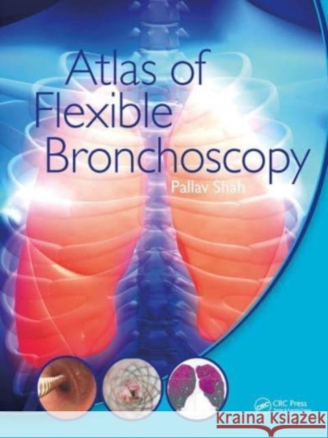 Atlas of Flexible Bronchoscopy Pallav Shah 9781032477589 CRC Press - książka