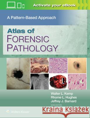 Atlas of Forensic Pathology: A Pattern Based Approach Walter L. Kemp 9781975222505 Wolters Kluwer Health - książka