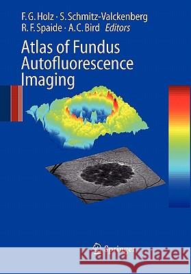 Atlas of Fundus Autofluorescence Imaging Frank G. Holz Steffen Schmitz-Valckenberg Richard F. Spaide 9783642091193 Springer - książka