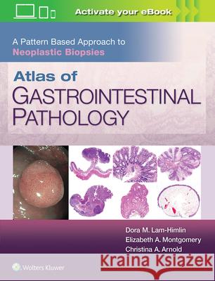 Atlas of Gastrointestinal Pathology: A Pattern Based Approach to Neoplastic Biopsies Christina Arnold Dora Lam-Himlin Elizabeth A. Montgomery 9781496367549 LWW - książka