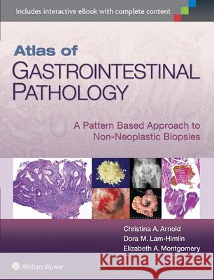 Atlas of Gastrointestinal Pathology: A Pattern Based Approach to Non-Neoplastic Biopsies Arnold, Christina 9781451188103 Lippincott Williams & Wilkins - książka