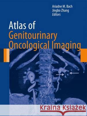 Atlas of Genitourinary Oncological Imaging Ariadne M. Bach Jingbo Zhang 9781461448716 Springer - książka