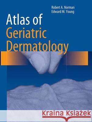 Atlas of Geriatric Dermatology Robert A. Norman Edward M. Youn 9781447171577 Springer - książka