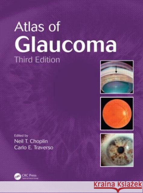 Atlas of Glaucoma Neil T Choplin & Carlo E Traverso 9781482209211 Taylor & Francis - książka