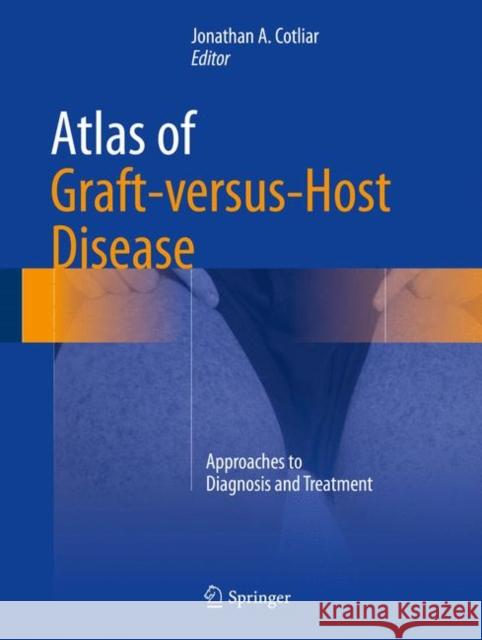 Atlas of Graft-Versus-Host Disease: Approaches to Diagnosis and Treatment Cotliar, Jonathan A. 9783319469508 Springer - książka