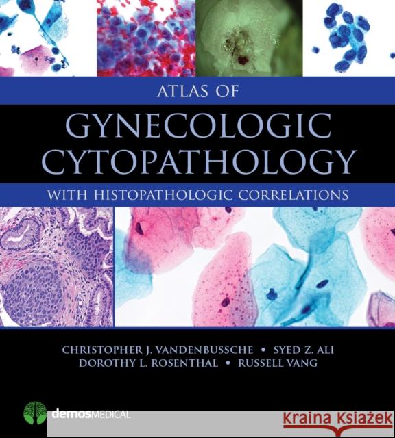 Atlas of Gynecologic Cytopathology: With Histopathologic Correlations Christopher Vandenbussche Syed Ali Dorothy Rosenthal 9781620700440 Demos Medical Publishing - książka