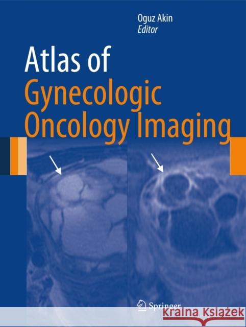 Atlas of Gynecologic Oncology Imaging Oguz Akin Harpreet K. Pannu 9781461472117 Springer - książka