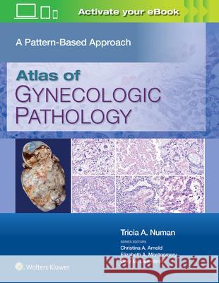Atlas of Gynecologic Pathology: A Pattern Based Approach Tricia Murdock Johanna Savage 9781975124762 LWW - książka
