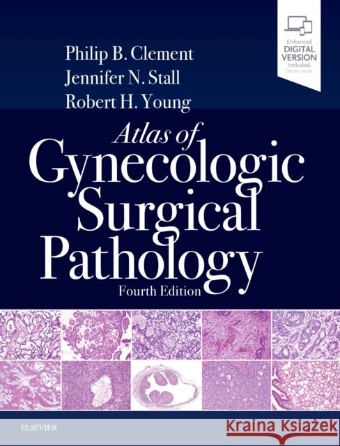 Atlas of Gynecologic Surgical Pathology Philip B. Clement Jennifer Stall Robert H. Young 9780323528009 Elsevier - książka