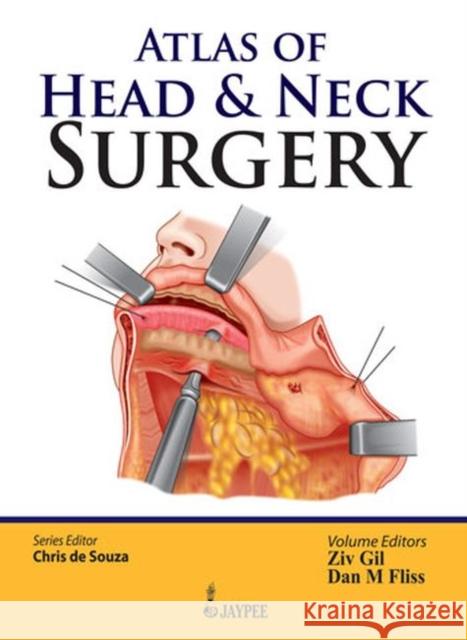 Atlas of Head & Neck Surgery Chris De Souza 9789350903803 Jp Medical Ltd - książka