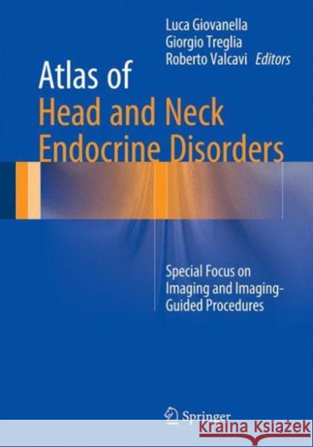 Atlas of Head and Neck Endocrine Disorders: Special Focus on Imaging and Imaging-Guided Procedures Giovanella, Luca 9783319222752 Springer - książka