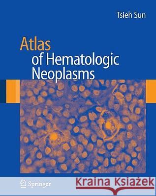 Atlas of Hematologic Neoplasms Tsieh Sun 9780387898476 Springer - książka