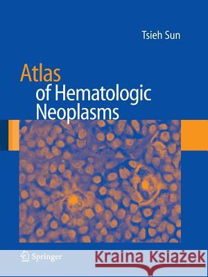 Atlas of Hematologic Neoplasms Tsieh Sun 9781489988799 Springer - książka