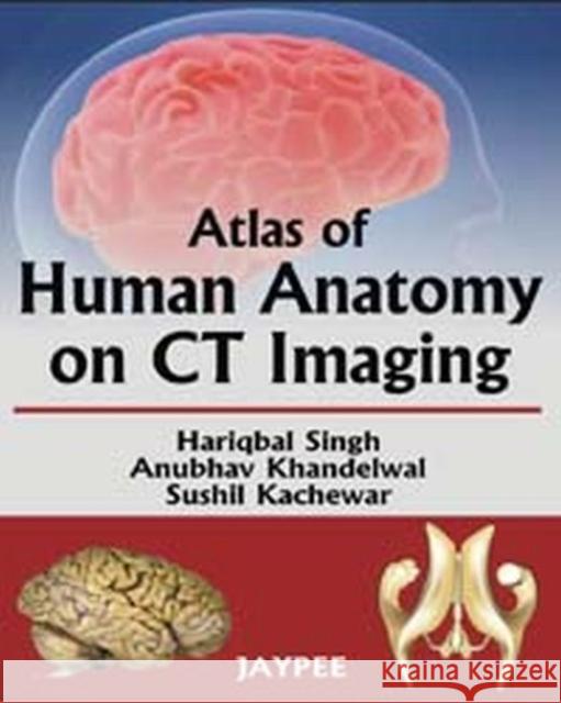 Atlas of Human Anatomy on CT Imaging  9788184489408 Jaypee Brothers Medical Publishers - książka