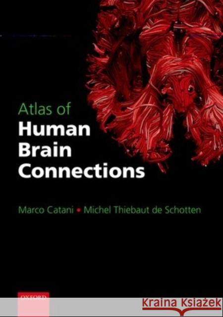 Atlas of Human Brain Connections Marco Catani Michel Thiebau 9780198729372 Oxford University Press, USA - książka