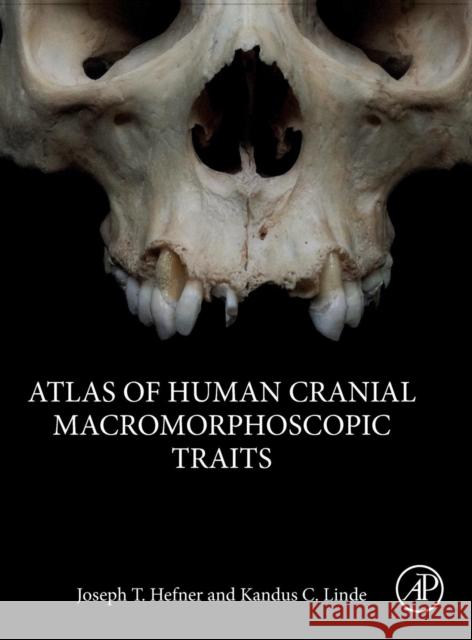 Atlas of Human Cranial Macromorphoscopic Traits Joseph T. Hefner Kandus C. Linde 9780128143858 Academic Press - książka