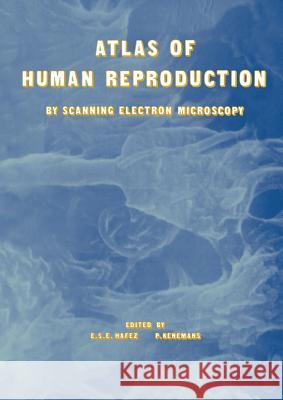 Atlas of Human Reproduction: By Scanning Electron Microscopy Hafez, E. S. 9789401181426 Springer - książka