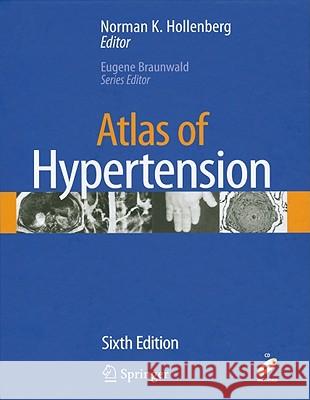 atlas of hypertension  Hollenberg, Norman K. 9781573403085 Current Medicine - książka