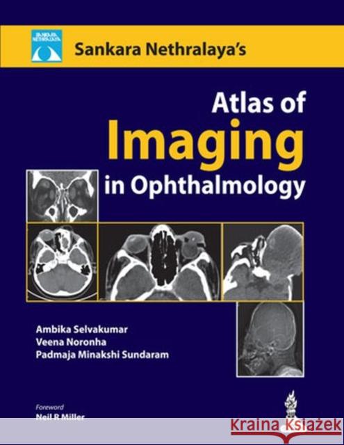 Atlas of Imaging in Ophthalmology  9788184489002 Jaypee Brothers Medical Publishers - książka