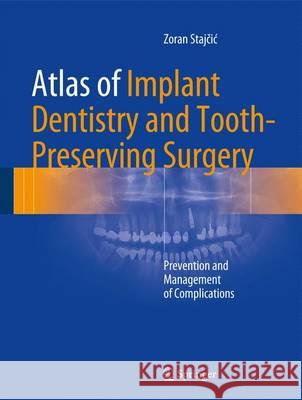 Atlas of Implant Dentistry and Tooth-Preserving Surgery: Prevention and Management of Complications Stajčic, Zoran 9783319421223 Springer - książka