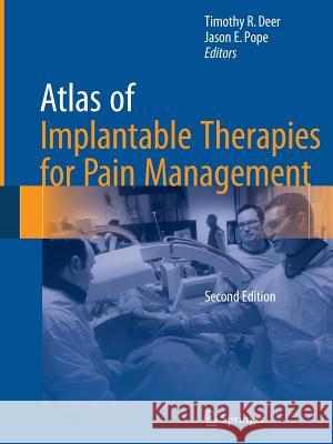 Atlas of Implantable Therapies for Pain Management Timothy R. Deer Jason E. Pope 9781493939497 Springer - książka