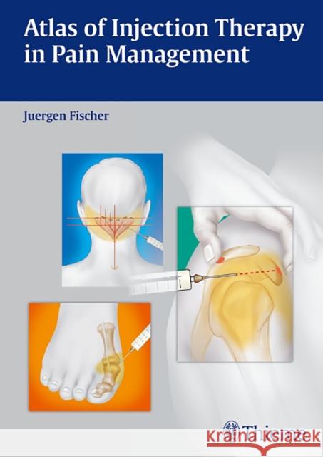 Atlas of Injection Therapy in Pain Management Juergen Fischer 9783131543011  - książka