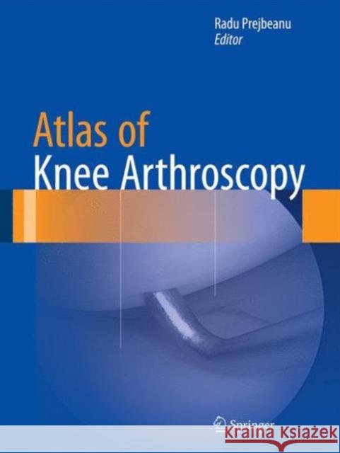 Atlas of Knee Arthroscopy Radu Prejbeanu 9781447165927 Springer - książka