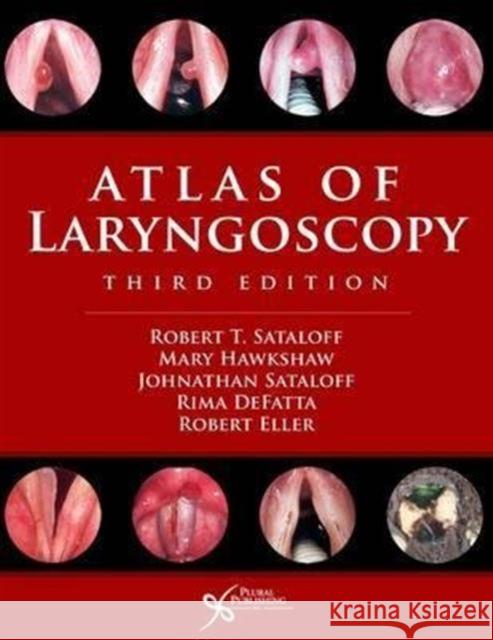 Atlas of Laryngoscopy Robert Thayer Sataloff Mary Hawkshaw Johnathan B. Sataloff 9781597564748 Plural Publishing Inc - książka