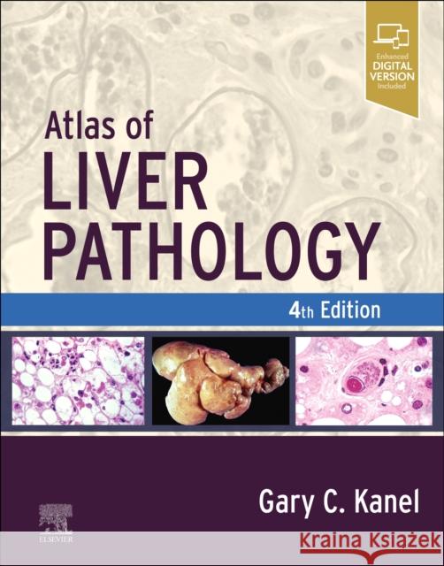 Atlas of Liver Pathology Gary C. Kanel 9780323825337 Elsevier - Health Sciences Division - książka