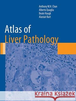 Atlas of Liver Pathology Wing Hung Anthony Chan Alberto Quaglia Beate Haugk 9781493943531 Springer - książka