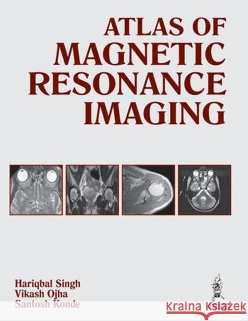 Atlas of Magnetic Resonance Imaging Hariqbal Singh 9789351521761 Jp Medical Ltd - książka