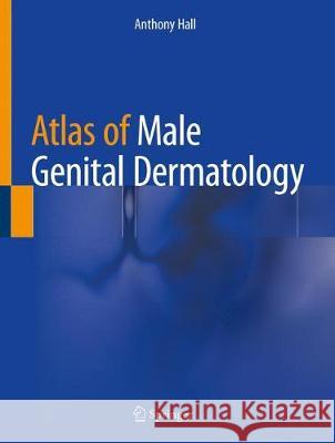 Atlas of Male Genital Dermatology Anthony Hall 9783319997490 Springer - książka