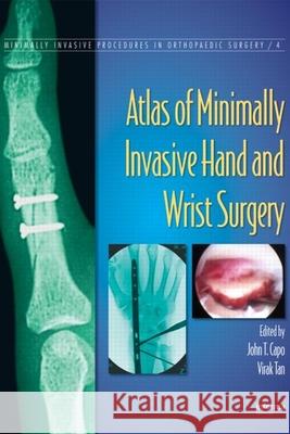 Atlas of Minimally Invasive Hand and Wrist Surgery John T. Capo Virak Tan 9780849370144 Informa Healthcare - książka