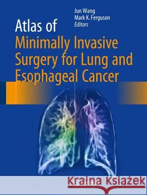 Atlas of Minimally Invasive Surgery for Lung and Esophageal Cancer Jun Wang Mark K 9789402408331 Springer - książka