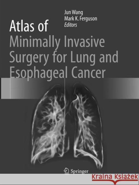 Atlas of Minimally Invasive Surgery for Lung and Esophageal Cancer Jun Wang Mark K 9789402414141 Springer - książka