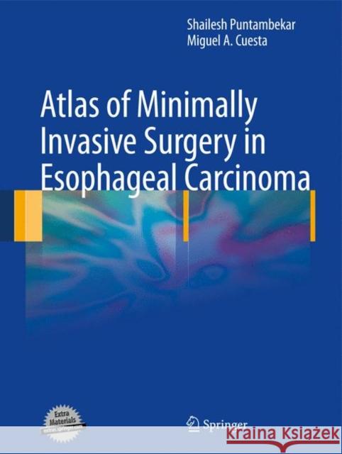 Atlas of Minimally Invasive Surgery in Esophageal Carcinoma Shailesh Puntambekar Shailesh Puntambekar Miguel A. Cuesta 9781848827677 Springer - książka