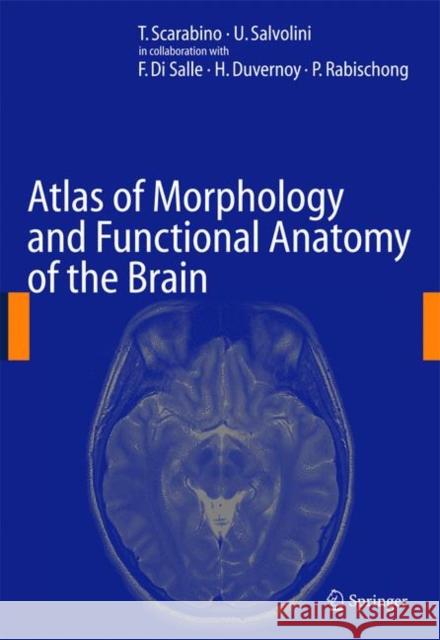 Atlas of Morphology and Functional Anatomy of the Brain T. Scarabino U. Salvolini 9783642067426 Springer - książka