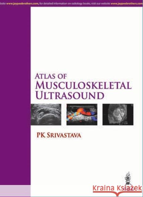 Atlas of Musculoskeletal Ultrasound PK Srivastava 9789351525196 Jaypee Brothers Medical Publishers - książka