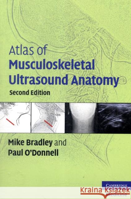 Atlas of Musculoskeletal Ultrasound Anatomy Michael Bradley 9780521728096  - książka