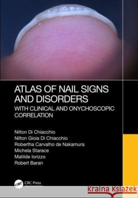 Atlas of Nail Signs and Disorders with Clinical and Onychoscopic Correlation Robert (Nail Disease Center, Cannes, France) Baran 9781032257907 Taylor & Francis Ltd - książka