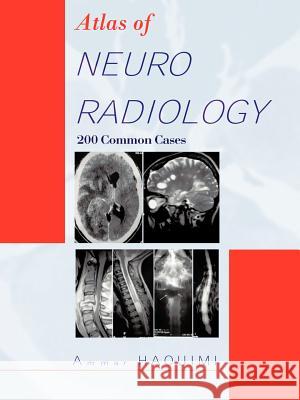 Atlas of Neuroradiology: 200 Common Cases Haouimi, Ammar 9781426969683 Trafford Publishing - książka