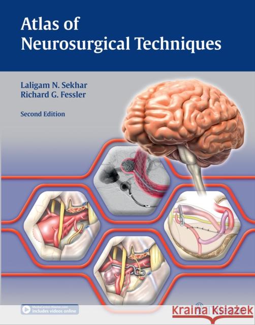 Atlas of Neurosurgical Techniques: Brain Sekhar, Laligam N. 9781626233881 Thieme Medical Publishers - książka