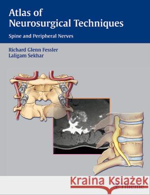 Atlas of Neurosurgical Techniques: Spine and Peripheral Nerves Richard G. Fessler Laligam N. Sekhar 9780865779877 Thieme Medical Publishers - książka