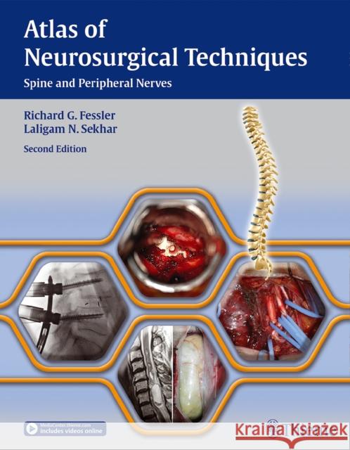 Atlas of Neurosurgical Techniques: Spine and Peripheral Nerves Fessler, Richard Glenn 9781626230545 Thieme Medical Publishers - książka