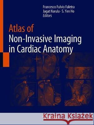 Atlas of Non-Invasive Imaging in Cardiac Anatomy Francesco Fulvio Faletra Jagat Narula S. Yen Ho 9783030355050 Springer - książka