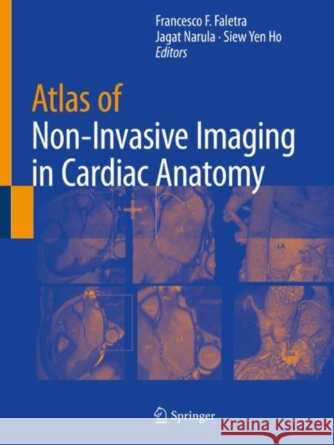 Atlas of Non-Invasive Imaging in Cardiac Anatomy Francesco F. Faletra Jagat Narula Siew Yen Ho 9783030355081 Springer - książka