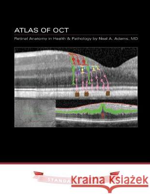 Atlas of OCT: Retinal Anatomy in Health & Pathology Neal Adams 9781687062109 Independently Published - książka