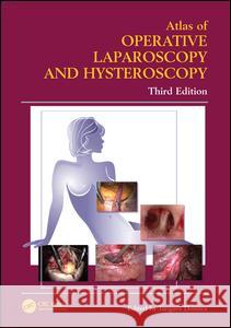 Atlas of Operative Laparoscopy and Hysteroscopy Jacques Donnez 9780415384155 Informa Healthcare - książka