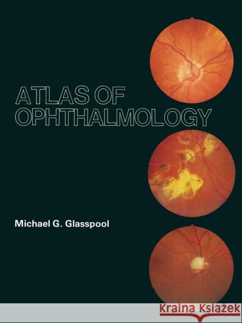 Atlas of Ophthalmology M. G. Glasspool 9789401172615 Springer - książka